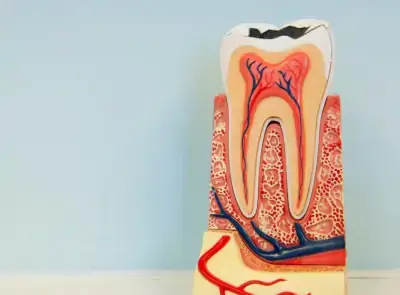 Root Canal Treatment