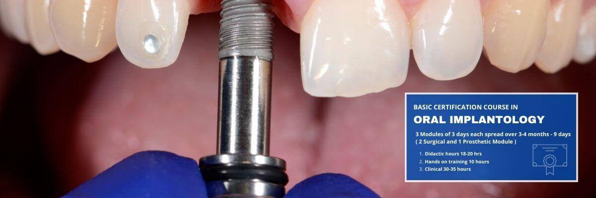 Basic Certification Course In Oral Implantology 2