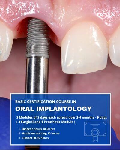 Basic Certification Course In Oral Implantology Mobile